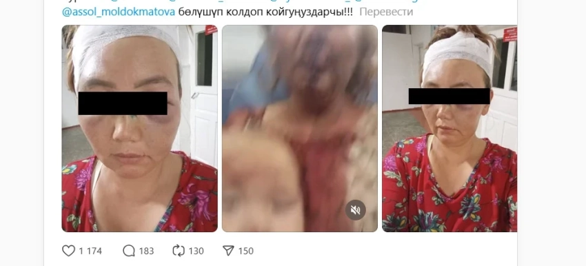 В милиции прокомментировали вызвавшее резонанс в соцсетях избиение жительницы Узгена. Фото