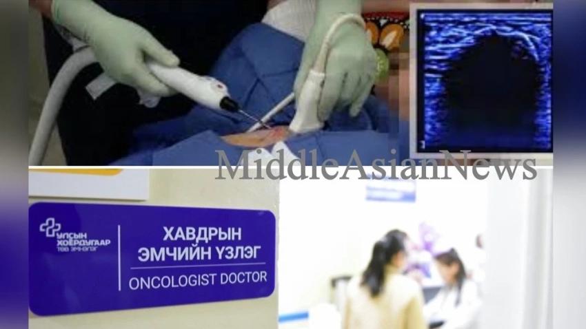 Монгольские онкологи начали применять новый метод замораживания опухолей