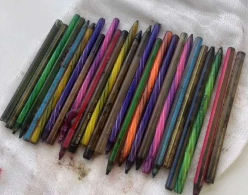 В Казахстане мужчина на спор проглотил 26 шариковых ручек