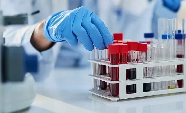 В крови переболевших COVID-19 нашли необычные структуры