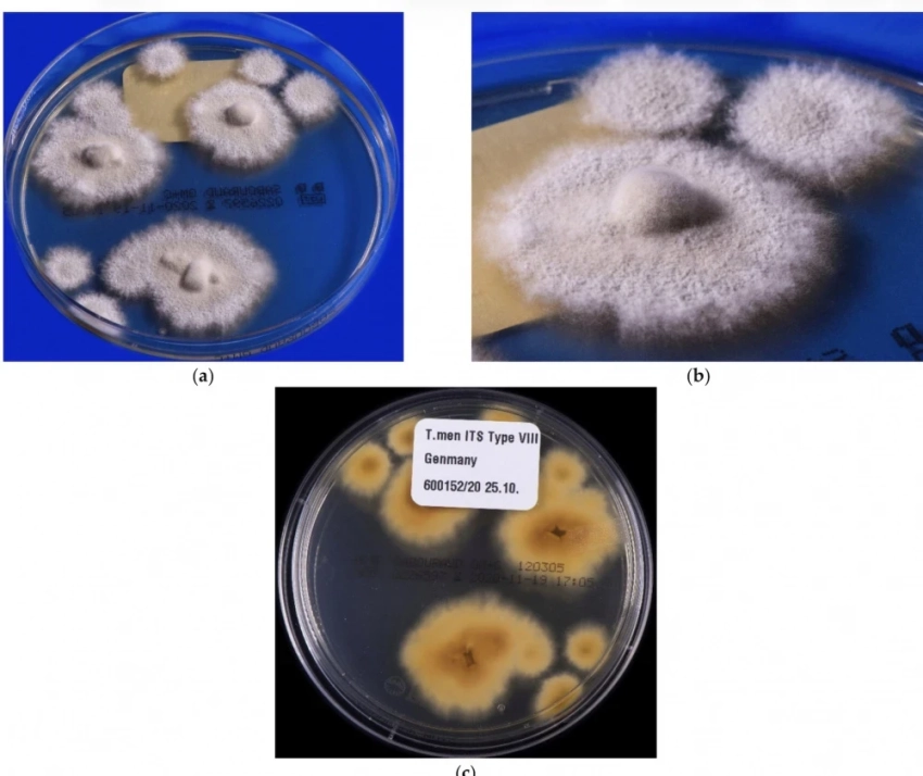 В Европе стремительно распространяется супергрибок, поражающий пах и ягодицы