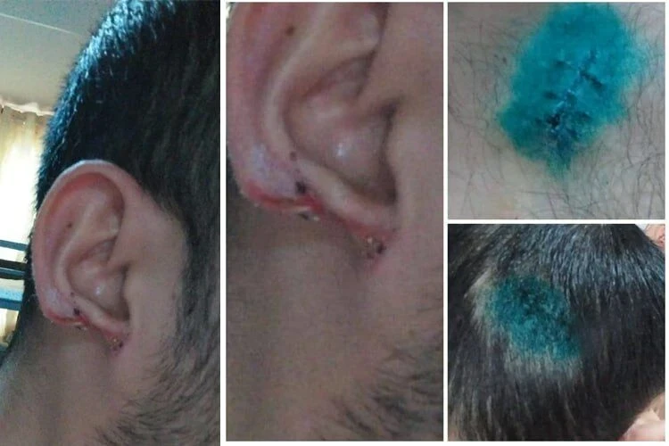 В Кочкор-Ате расследуют ножевое нападение на фоне семейного скандала и насилия