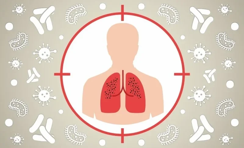 Туберкулез. Что нужно знать о болезни и почему важно вовремя обращаться к врачу