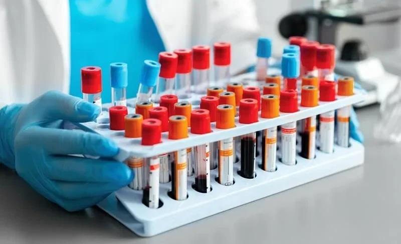 Минздрав планирует вернуть скидку в 50% в сети лабораторий Бонецкого для тяжело больных пациентов