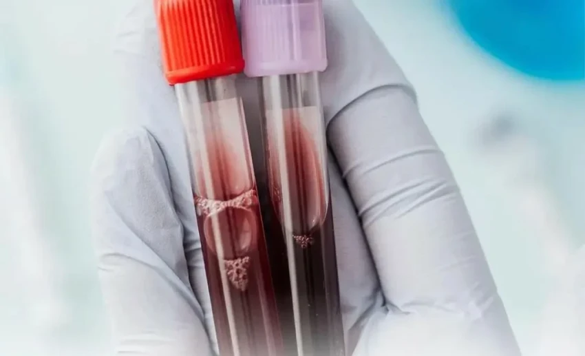 Бишкекские врачи рассказали, как предупредить анемию